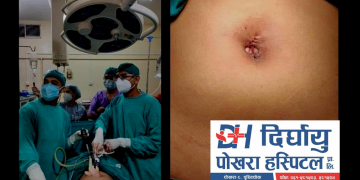 पोखरामै पहिलो पटक दिर्घायु पोखरा अस्पतालमा ल्याप्रोस्कोपी विधिबाट पाठेघर सम्बन्धी शल्यक्रिया हुने।