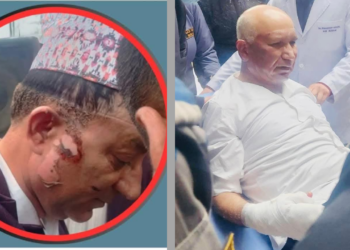 आगोको ज्वालाले घाइते उपप्रधानमन्त्री पौडेल र मेयर आचार्यको कीर्तिपुर बर्न अस्पतालमा उपचार जारी